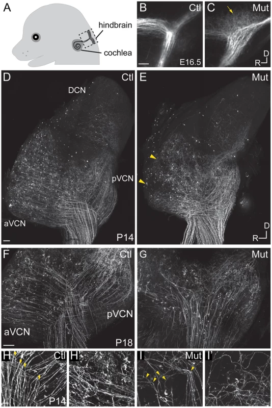 <i>Npr2</i> mutant mice show SGN central axon guidance and bifurcation defects.