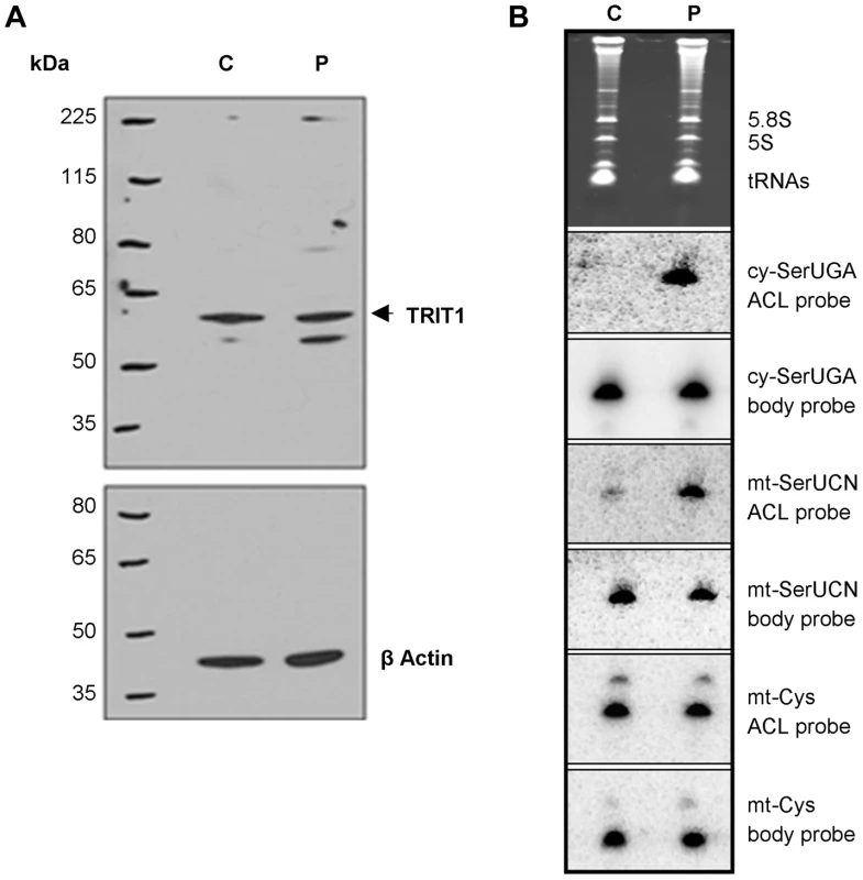The <i>TRIT1</i> mutation disrupts modification activity on cytosolic and mitochondrial tRNAs but not enzyme abundance.