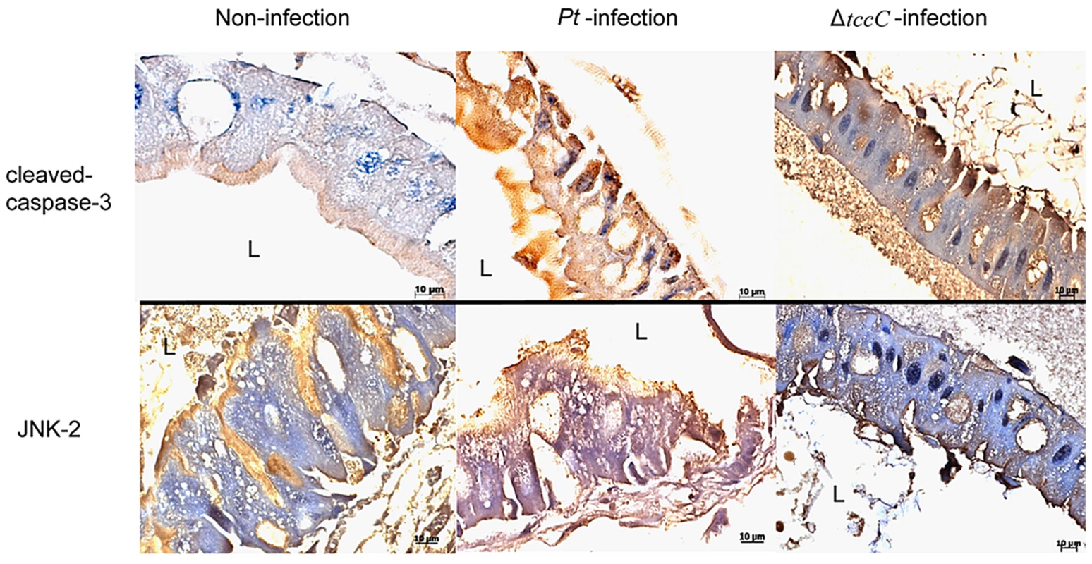 Immunohistochemical analysis of cleaved-caspase-3 and JNK-2 protein expression level in the gut tissue of <i>P. xylostella</i> larva.