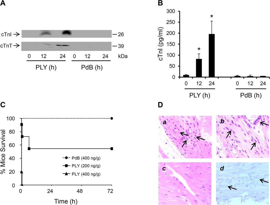 Circulating pore-forming PLY mediates cardiac injury and inflammation <i>in vivo</i>.