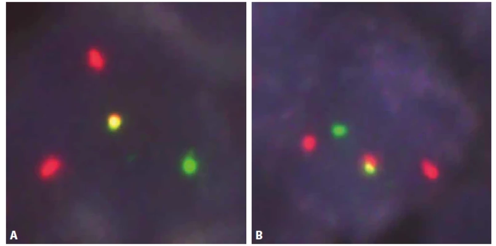 Fluorescenční in situ hybridizace – jádra buněk komponenty ISMCN.