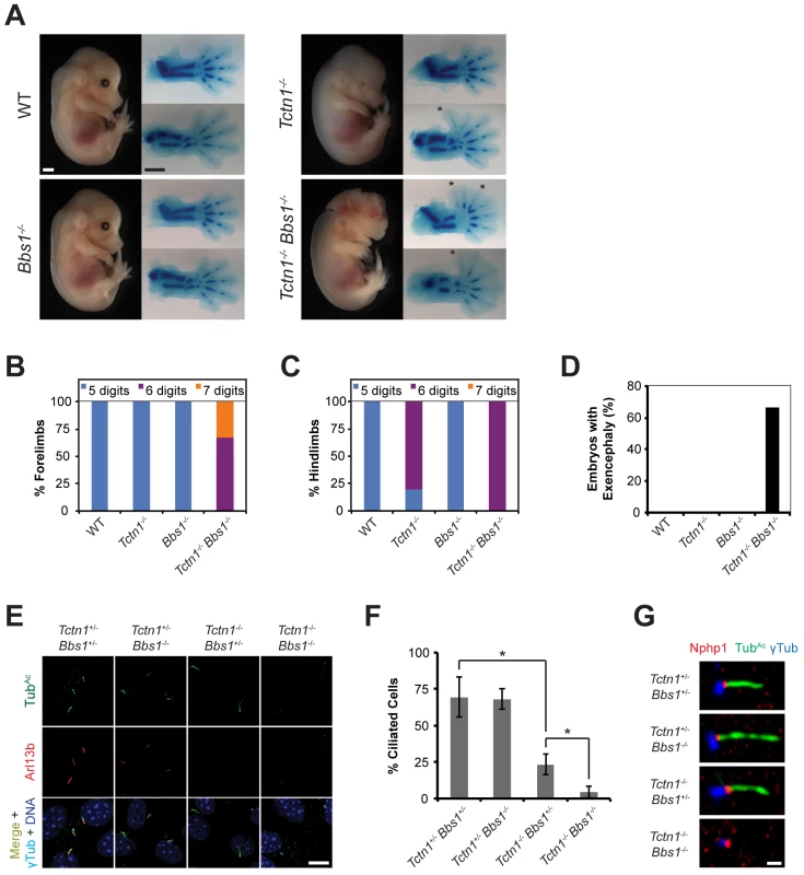 Mouse <i>Tctn1</i> genetically interacts with <i>Bbs1</i>.