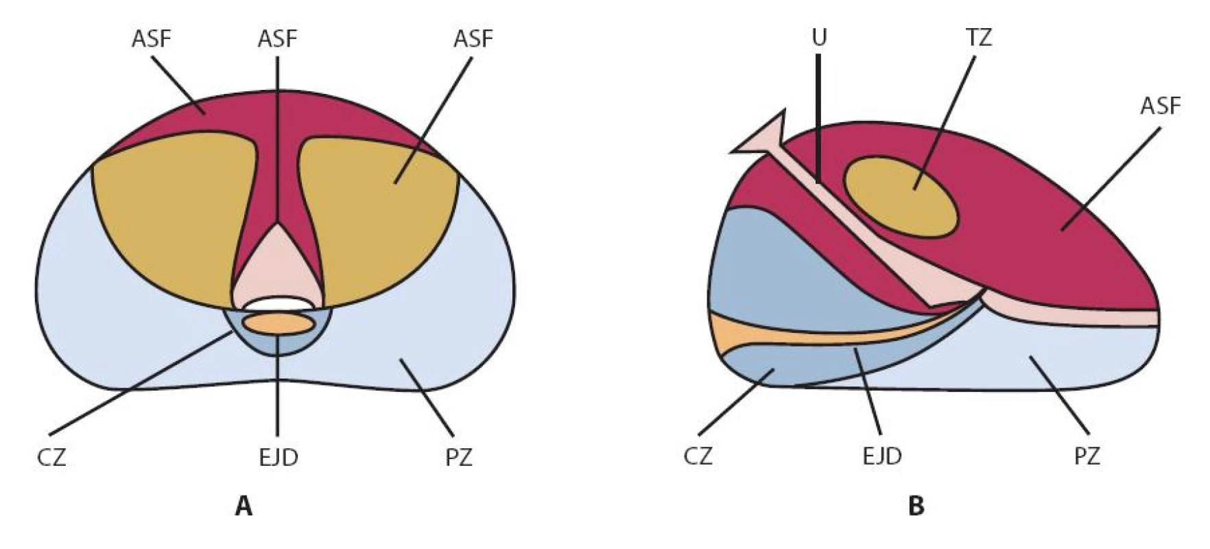 McNealovo schéma zonální anatomie prostaty (podle (17))
A – sagitální řez; B – transverzální řez. AFS – fi bromuskulární stroma , CZ – centrální zóna, EJD – ductus ejaculatorii, NVB – neurovaskulární svazek, PZ – periferní zóna, TZ – tranzicionální zóna, U – uretra
Fig. 1. McNeal scheme of the prostatic zonal anatomy (adapted from (17))
A – sagittal section; B – transversal section. AFS – anterior fi bromuscular stroma, CZ – central zone, EJD – ejaculatory ducts, PZ – peripheral zone, TZ – transitional zone, U – urethra