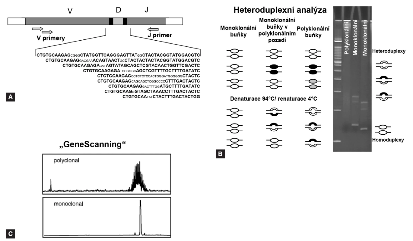 Analýza heteroduplexů a „GeneScanning“. A: pozice primerů pro PCR screening Ig/TCR přestaveb. B: analýza heteroduplexů se provádí na 6-8% polakrylamidovém gelu po denaturaci a následné rychlé renaturaci. Homoduplexy formované z monoklonálních produktů díky stejné velikosti a sekvenčního složení vytvoří při migraci gelem jediný proužek, heteroduplexy vzniklé náhodným spojením polyklonálních produktů migrují v gelu pomaleji a vytvoří neostře ohraničený široký pruh „smear“. C: „GeneScanning“ odliší denaturované produkty PCR s velkým rozlišením podle délky, je nutné značení PCR primerů fluorochromem.