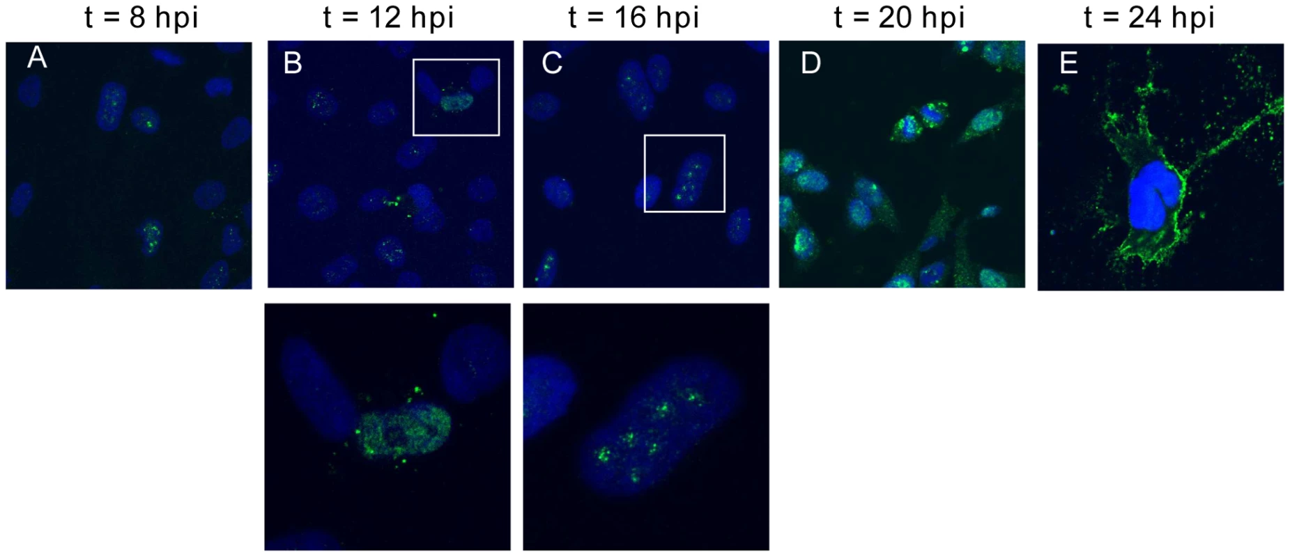 Nuclear-cytoplasmic trafficking of Nipah virus matrix protein (NiV-M) during live viral infection.