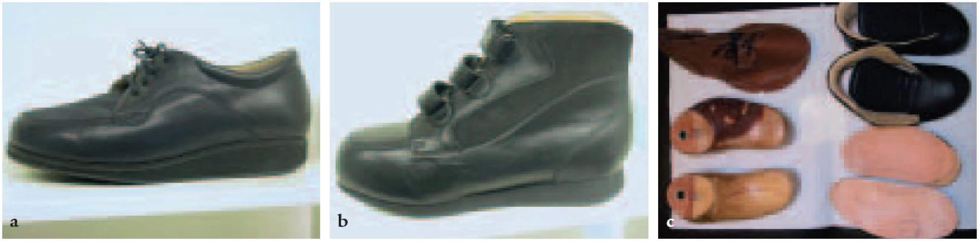 Individuální obuv. C: Rozpracovaná individuální obuv.