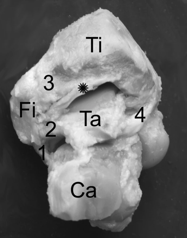 Pohled na zadní plochu hlezenního kloubu v prenatálním období. 1 – lig. fibulocalcaneare, 2 – lig. fibulotalare post., 3 – lig. tibiofibulare post., 4 – tibiotalare post. Hvězdička označuje lig. tibiofibulare posterius inferius. Ca – calcaneus, Fi – fibula, Ta – talus, Ti – tibia