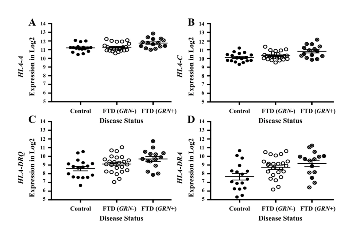 Pleiotropic genes between frontotemporal dementia (FTD) and immune-related diseases are elevated in brains of patients with FTD with <i>GRN</i> mutation.