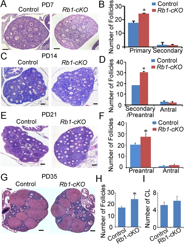 Aberrant follicle development in mice with conditional <i>Rb1</i> inactivation in oocytes.