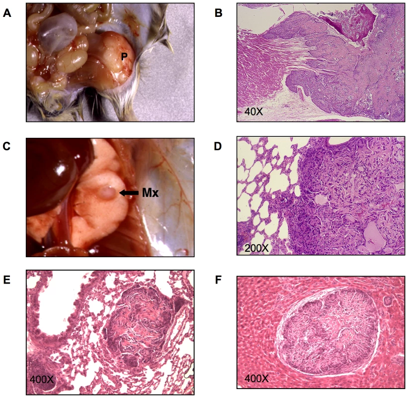 Primary and metastatic bone tumors from CZ mice.