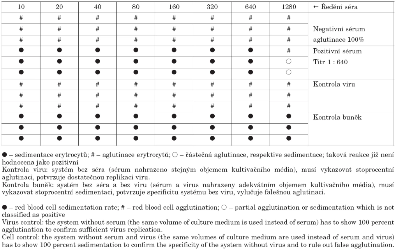 Vzor hodnocení mikroneutralizačního testu

Table 2. Example evaluation of microneutralization assay results