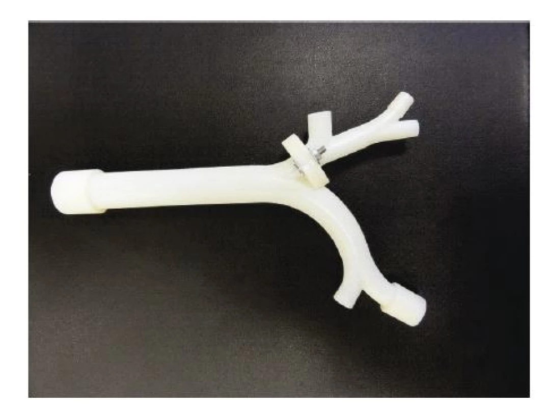 Výsledný model centrálních dýchacích cest vytisknutý na 3D tiskárně. 