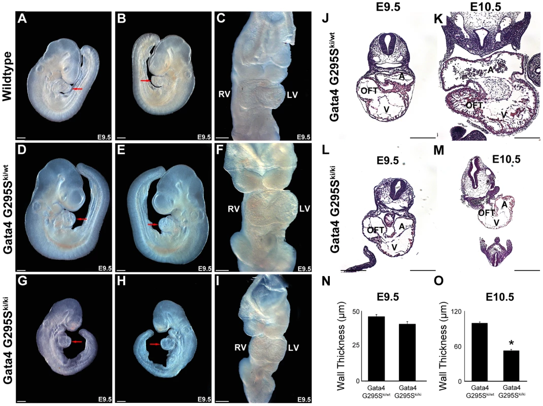 <i>Gata4 G295S<sup>ki/ki</sup></i> mice display growth retardation and a thin myocardium.