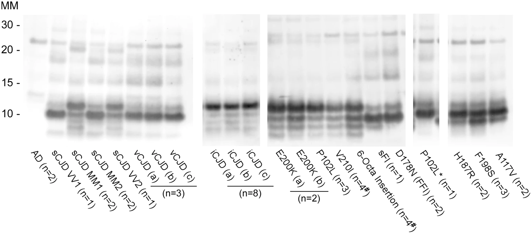 Western blot of BV rPrP<sup>Res</sup> products from RT-QuIC reactions seeded with various human prion types.