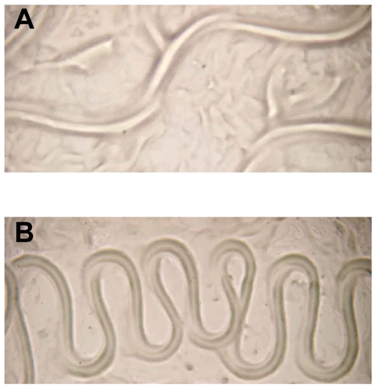 Aberrant translocation of <i>C. elegans</i> on <i>Y. pseudotuberculosis.</i>