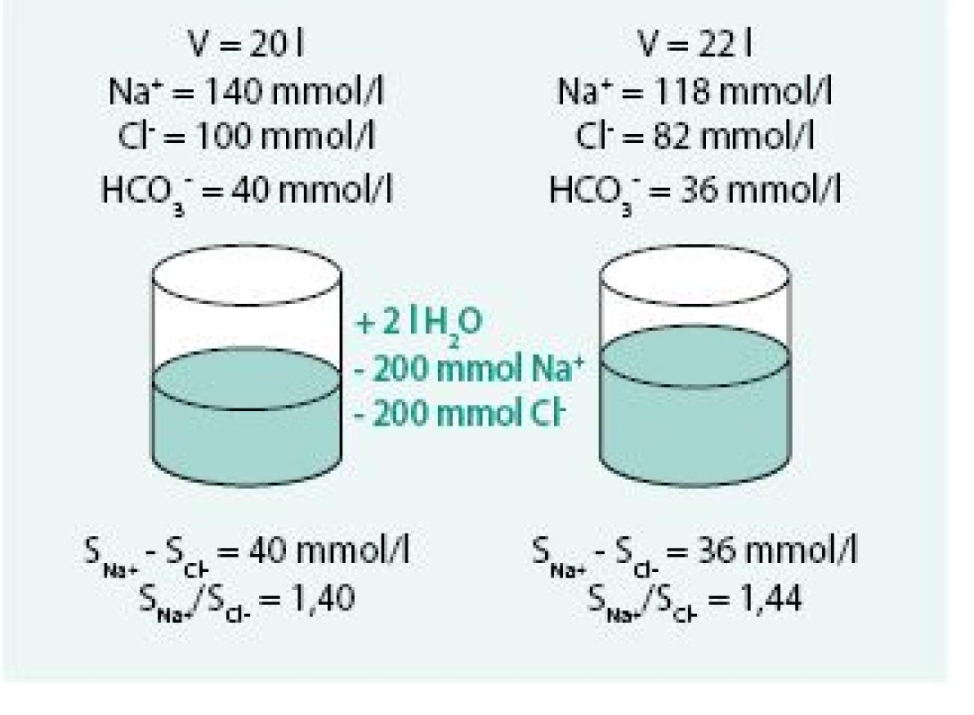 Model kombinace retence vody při současné depleci sodíku (kombinace diluční a depleční hyponatremie)