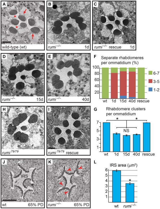 Loss of the enzymatic function of Rumi results in rhabdomere adhesion.