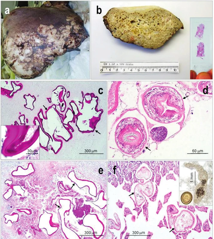 &lt;i&gt;Echinococcus multilocularis&lt;/i&gt;
a) Pozdní stadium humánní alveolární echinokokózy v játrech s reparativními změnami a fibrózou.
b) Průřez alveokokem z jater fixovaných ve formolu ukazuje na „houbovitou“ strukturu parazita; ve výřezu histologický preparát alveokoka, na němž je již makroskopicky viditelná PAS pozitivní laminární membrána.
c–f) Histologický obraz:
c) nejčastěji prokazovaný sterilní alveokok v játrech člověka – germinativní vrstvu obklopuje bezbuněčná laminární membrána (šipky; detail ve výřezu), intenzivně se barvící PAS;
d) vzácně detekovaný fertilní alveokok s protoskolexy (šipky), opatřené přísavkami a háčky, (H&amp;E);
e) metacestoda v jaterní tkáni prasete divokého, (PAS), se shodným obrazem jako c);
f) dospělých tasemnic (šipky) v tenkém střevě kočky s viditelnými přísavkami a háčky, (H&amp;E), ve výřezu dospělá tasemnice a vajíčko (vel. 30–36 x 25–30 μm).
Snímek a) laskavě zapůjčila MUDr. V. Žampachová, I. patologicko-anatomický ústav, FNUSA a MU v Brně.
Figure 2. &lt;i&gt;Echinococcus multilocularis&lt;/i&gt;
a) Late phase of human alveolar echinococcosis in the liver with fibrosis and reparative changes;
b) Cross section through the parasitic „spongiform“ lesion, in detail a histological mount with macroscopically visible laminated membrane, (PAS);
c–f) Histological picture of:
c) sterile parasitic vesicles with strongly PAS stained laminated membrane (arrows; detail) are mostly detected;
d) fertile parasites with protoscoleces (arrows) are scarcely detected, (H&amp;E);
e) sterile metacestode in the liver of wild board, (PAS), the same pictitres as in c;
f) adult cestodes in the cat small intestine; in details adult cestode and egg (size 30–36 x 25–30 μm). 
Figure a) Courtesy of V. Žampachová, First department of Pathological Anatomy Masaryk University and St. Anne&amp;s Faculty Hospital in Brno.