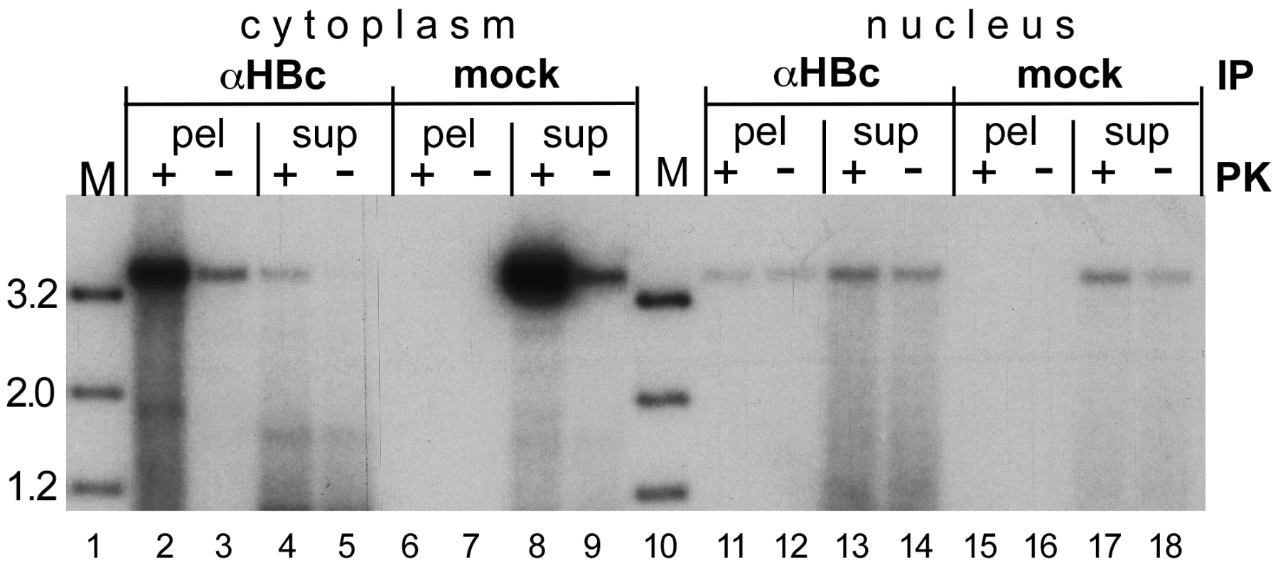 Evidence for a fraction of completely uncoated, largely protein-free nuclear HBV RC-DNA.