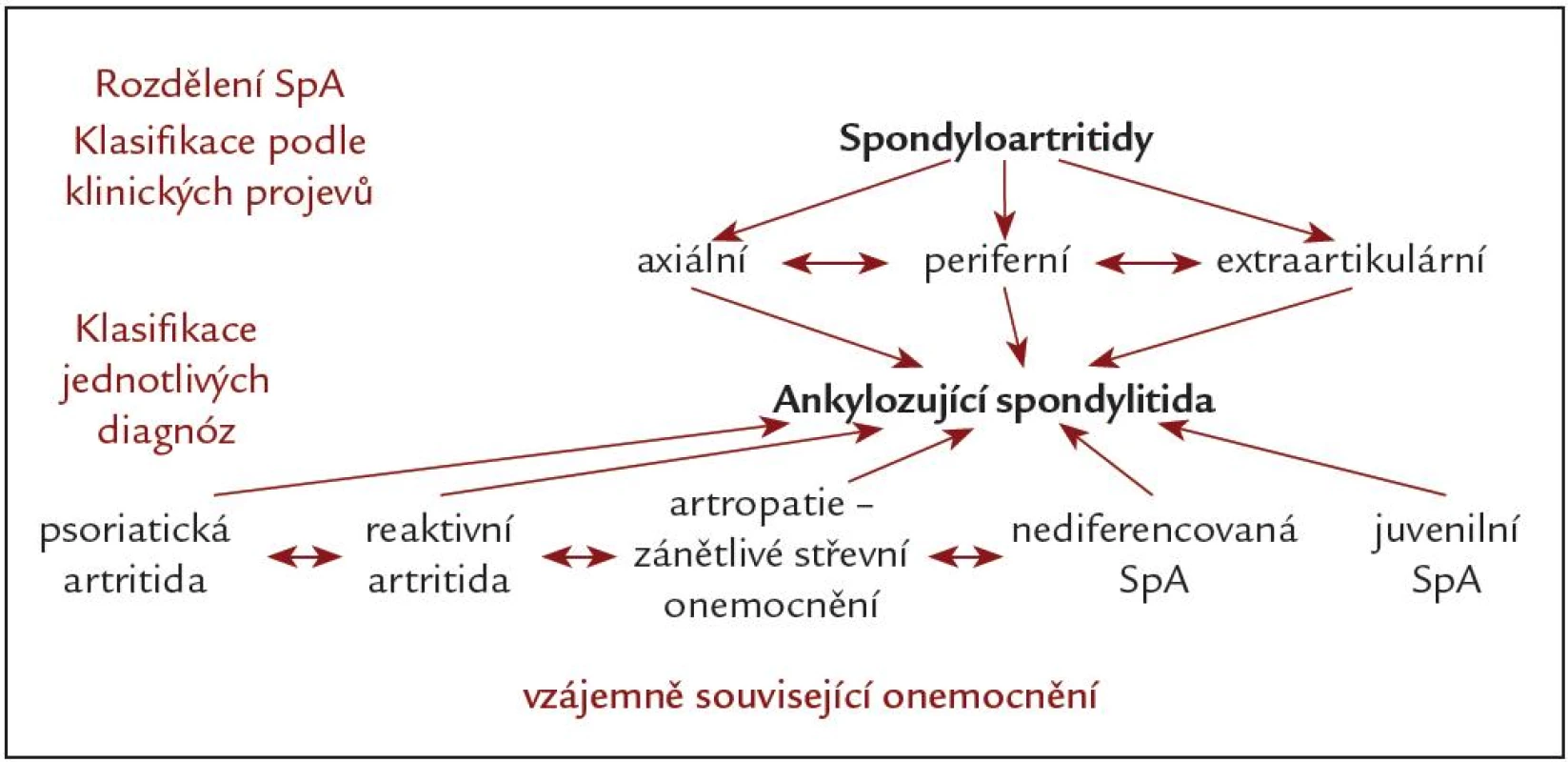 Spondyloartritidy.