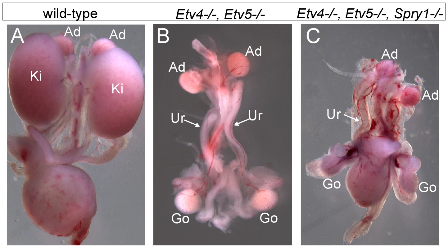 Loss of <i>Spry1</i> does not rescue kidney development in <i>Etv4−/−;Etv5−/−</i> mice.