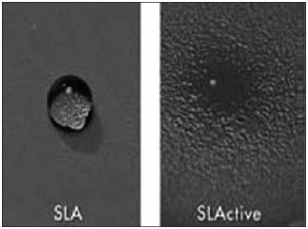 Hydrofilní povrch SLActive v porovnání s hydrofobním povrchem SLA (pouze pískovaný a leptaný) – převzato z [35].