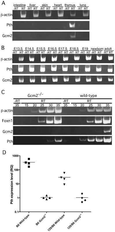<i>Pth</i> expression in misplaced parathyroid cells was co-expressed with <i>Gcm2</i> and down-regulated in <i>Gcm2</i>-null mutant mice.