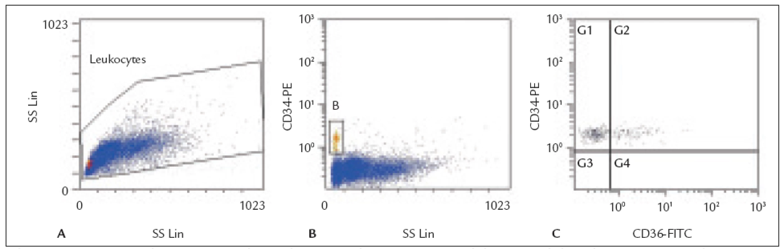 Histogramy z flow cytometrické analýzy transplantátu periferních kmenových buněk (PBSC).
A: Leukocyty – gating na histogramu forward-scatter (FS) vs. side-scatter (SS). 
B: CD34&lt;sup&gt;+&lt;/sup&gt; buňky (gate B) identifikované na histogramu CD34 PE vs. side-scatter (SS). 
C: Exprese antigenu CD36 na CD34&lt;sup&gt;+&lt;/sup&gt; buňkách – histogram CD34 PE vs. CD36 FITC (subpopulace
CD34&lt;sup&gt;+&lt;/sup&gt;36&lt;sup&gt;+&lt;/sup&gt; buněk se nachází v kvadrantu G2).