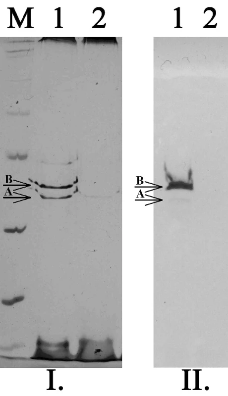 SDS-PAGE (I.) a detekce porinů pomocí specifických protilátek (II.) u kmenů K. pneumoniae. M – standard molekulových hmotností, 1 – kmen citlivý ke karbapenemům exprimující oba hlavní poriny (OmpK35 – A, OmpK36 – B), 2 – kmen rezistentní ke karbapenemům velmi slabě exprimující pouze OmpK35
Fig. 3. SDS-PAGE and Western-blott detection of porins in K. pneumoniae strains. M – marker of molecular weight, 2 – strain susceptible to carbapenems expressed both main porins (OmpK35 – A, OmpK36 – B), 2 – strain resistant to carbapenems expressed only OmpK35 in very low level