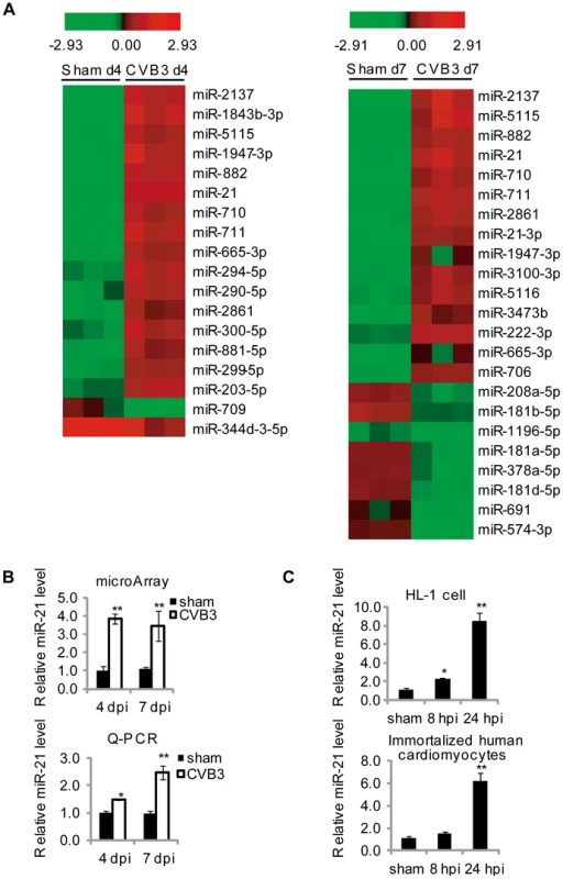 CVB3 infection upregulates miR-21 expression.