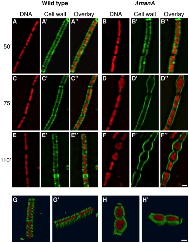 Following cell wall architecture and chromosome morphology.