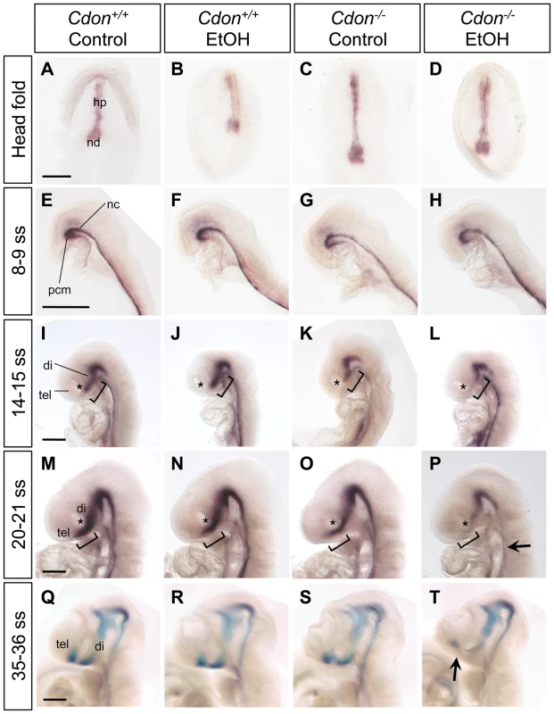 Defective expression of <i>Shh</i> in the ventral forebrains of ethanol-treated <i>Cdon<sup>−/−</sup></i> embryos.
