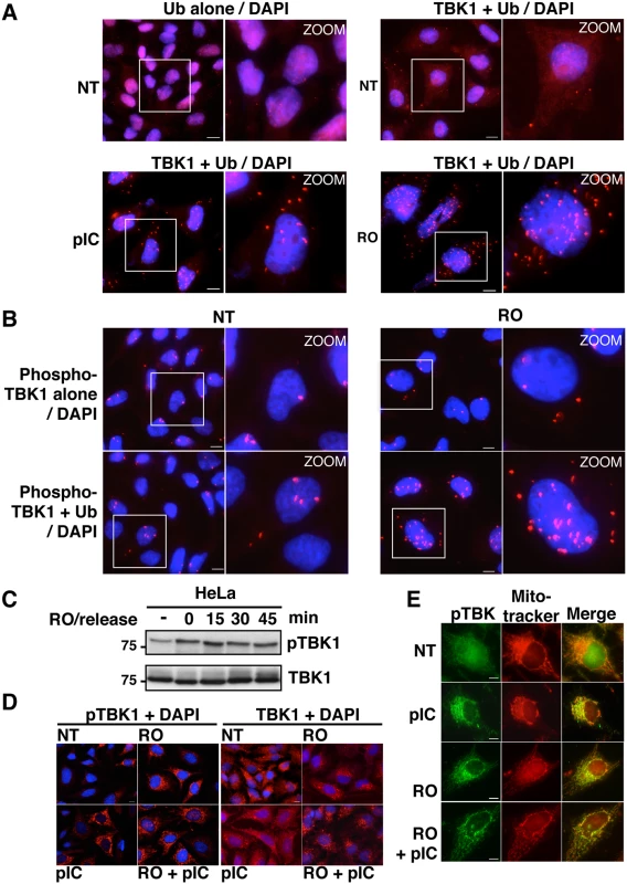 Activity and subcellular localization of TBK1 are altered in G2/M synchronized cells.
