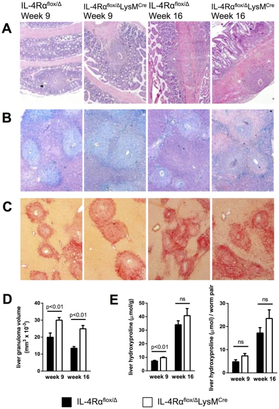 Inflammation but not fibrosis is exacerbated in chronically infected IL-4Rα<sup>flox/Δ</sup>LysM<sup>Cre</sup> mice.