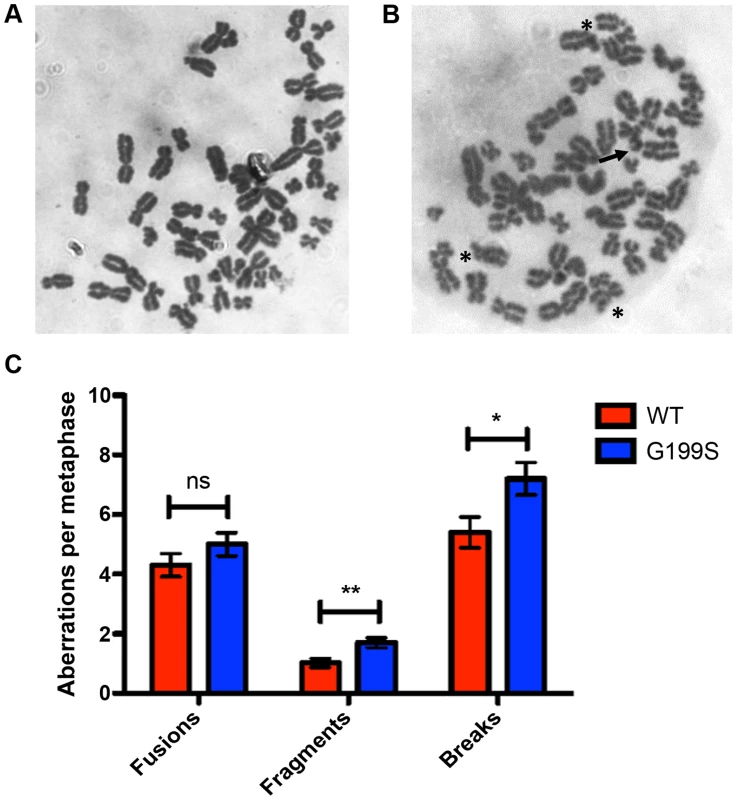 Expression of G199S leads to induction of chromosomal aberrations.
