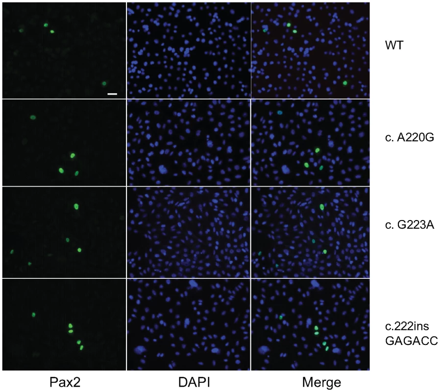 Pax2 immunofluoresence on COS-7 cells transfected with wild-type or mutant <i>Pax2</i> expression vectors.
