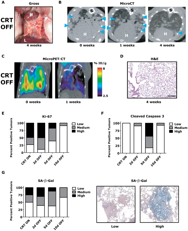 <i>Kras<sup>G12D</sup></i>/<i>Twist1</i>-induced lung tumors regress following combined oncogene inactivation.