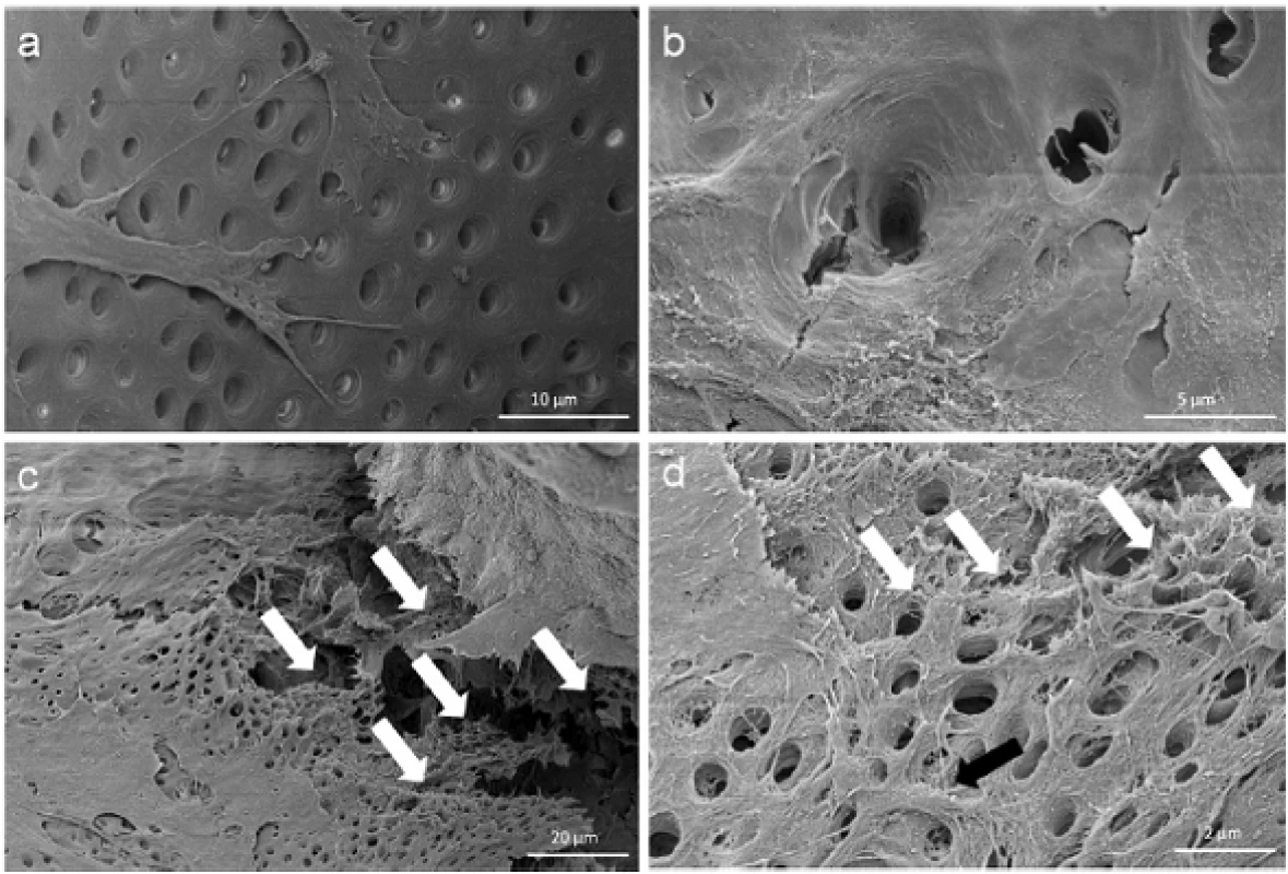 Cell behavior on bovine dentin. Scanning electron microscopic images show the bovine dentin surface orientated migration of outgrown pulp sphere cells (a) and the vortical ingrowth into the dentinal tubules as well as the covering of the tubular walls by these cells (b). Multilayered cell formations with cellular emulation of three-dimensional dentin structures could be detected in the multi layered outgrowth area adjacent to a sphere (white arrows in Figure 6c). The white arrows in figure (d) denote the fibrillar dentin tissue-like structure over numerous cell layers (black arrow).