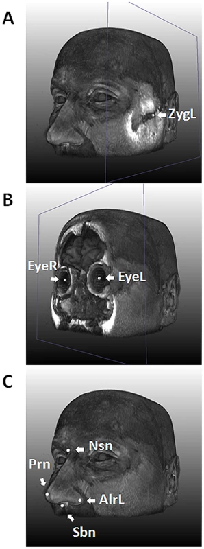 Nine facial landmarks extracted via image registration tools from 3D MRIs.