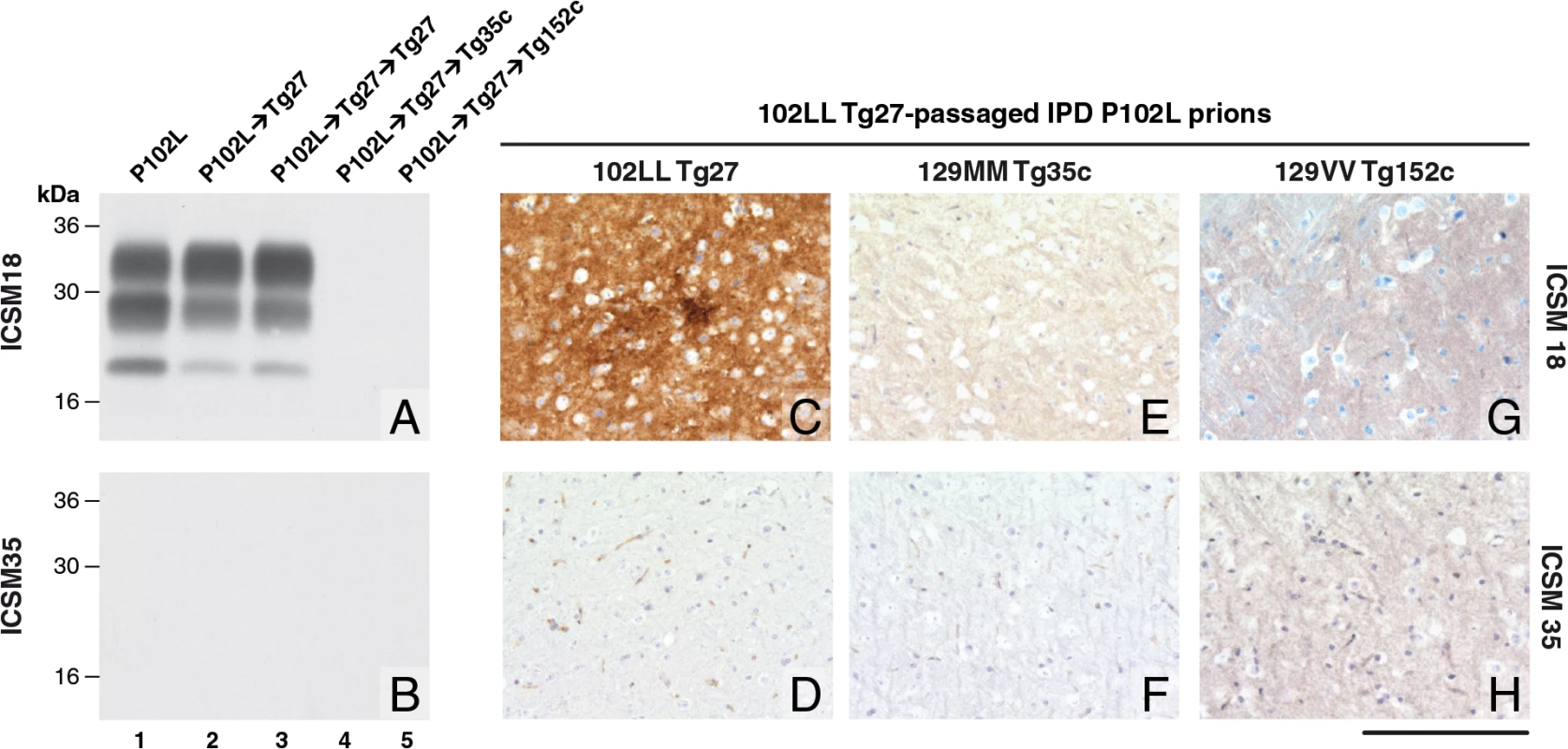 Detection of disease-related PrP by immunohistochemistry and immunoblotting in brains of transgenic mice inoculated with GSS-102L prions.