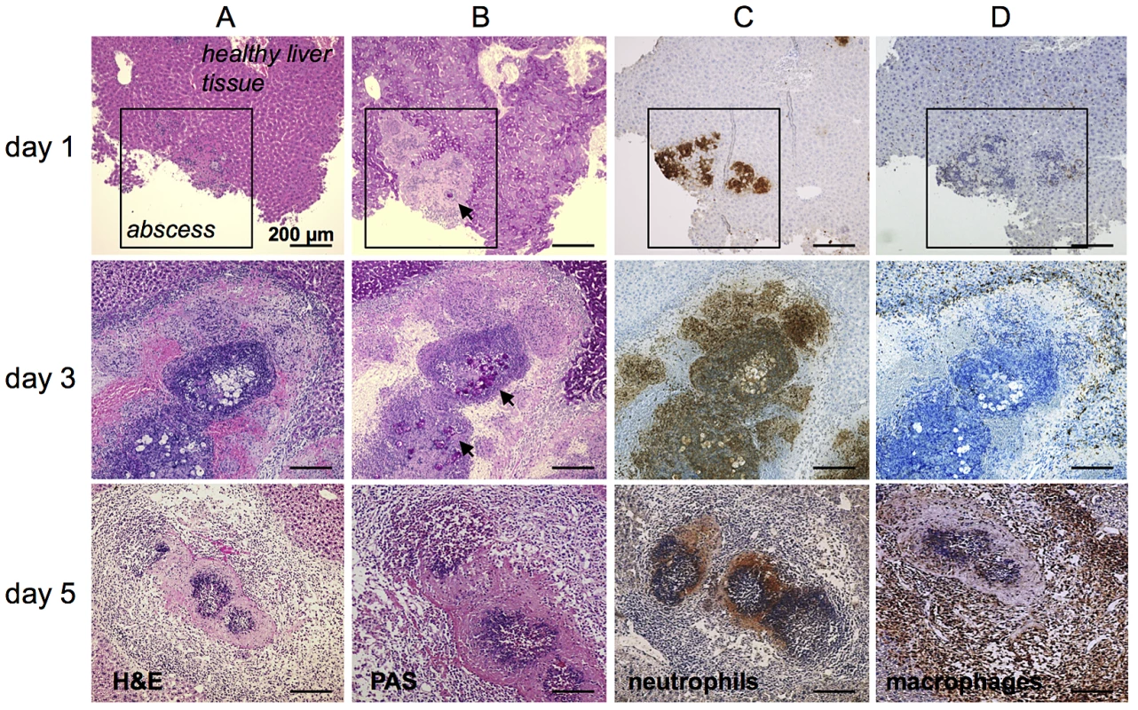 Histological and immunohistochemical characterization of cell infiltrates during ALA.