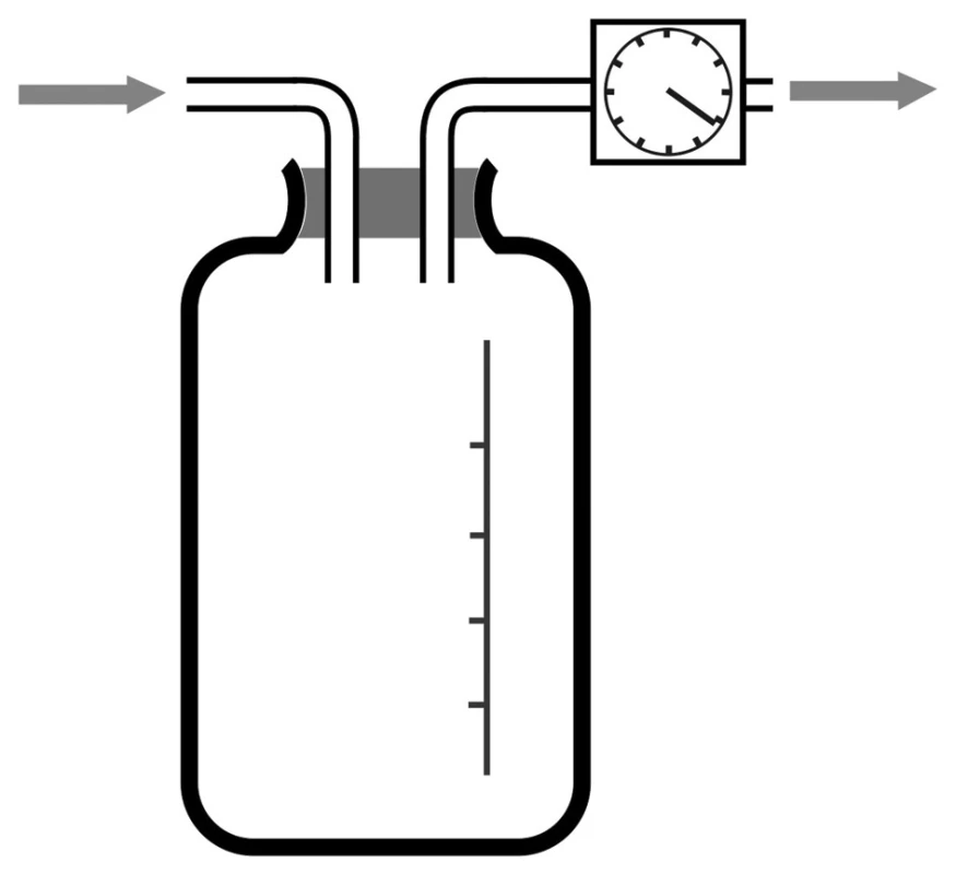 Bülauova drenáž (drenážní systém s vodním zámkem)
Fig. 1: Bülau drainage (water seal drainage system)