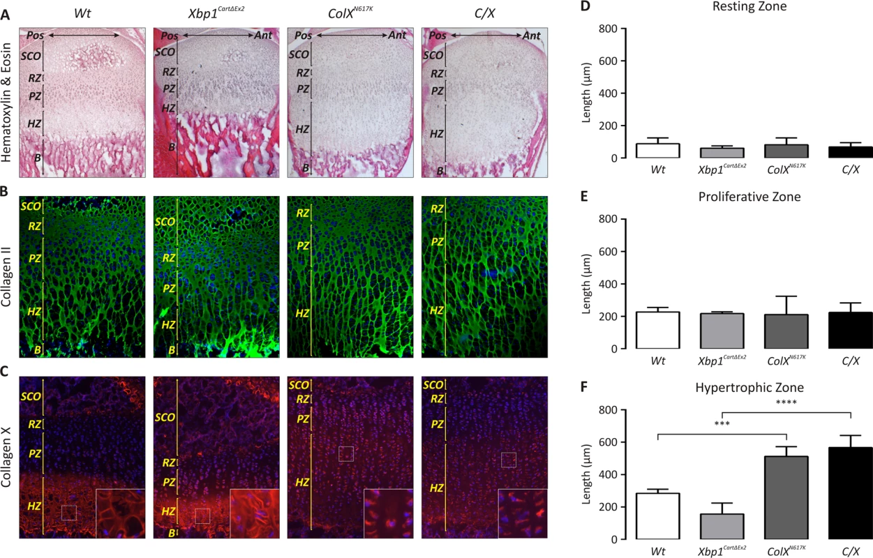 Ablation of XBP1 does not significantly affect the MCDS phenotype in <i>C/X</i> mice.