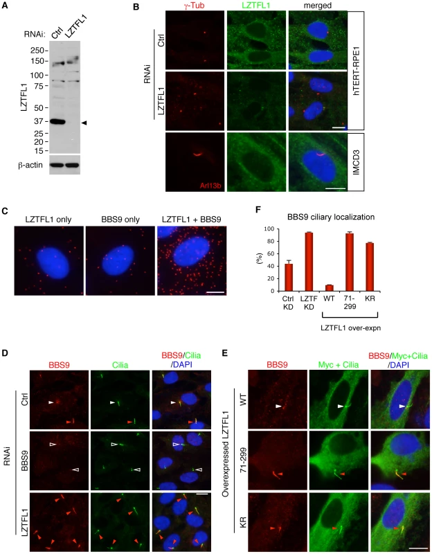 LZTFL1 regulates ciliary trafficking of the BBSome.