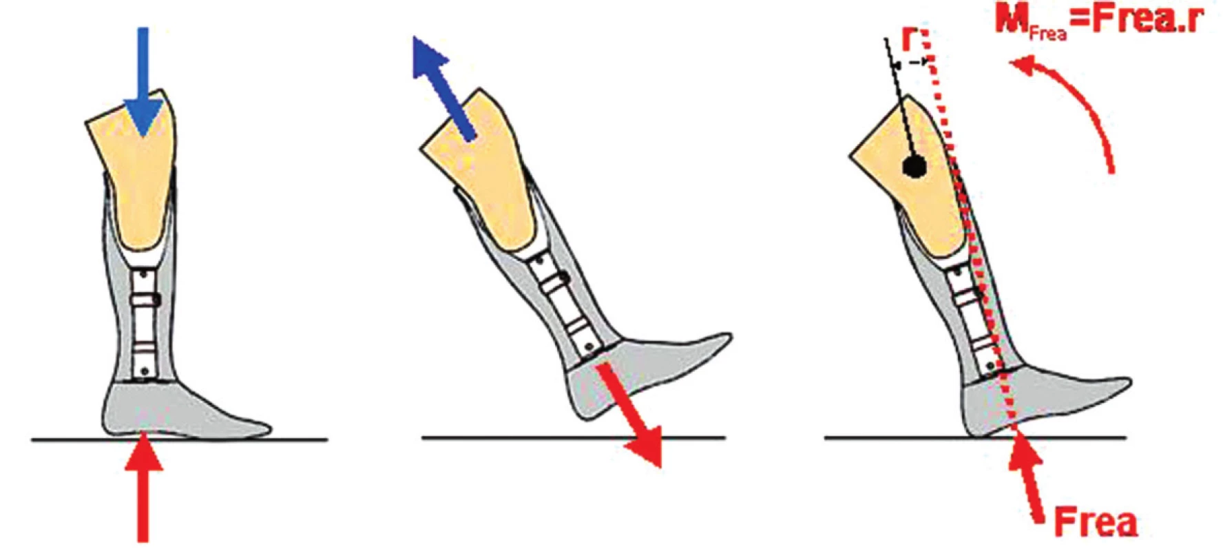 Pohyb pahýlu v protetickém lůžku ve stojné (a) a švihové (b) fázi kroku. Otáčivý účinek (M) reakční síly podložky (c) při kontaktu chodidla s podložkou.