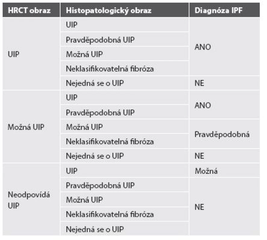 Kritéria pro diagnostiku IPF.