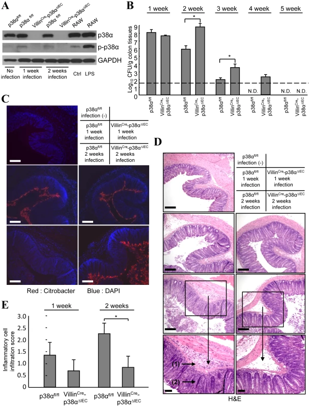 p38α in intestinal epithelial cells is required for the immunity to <i>C. rodentium</i>.