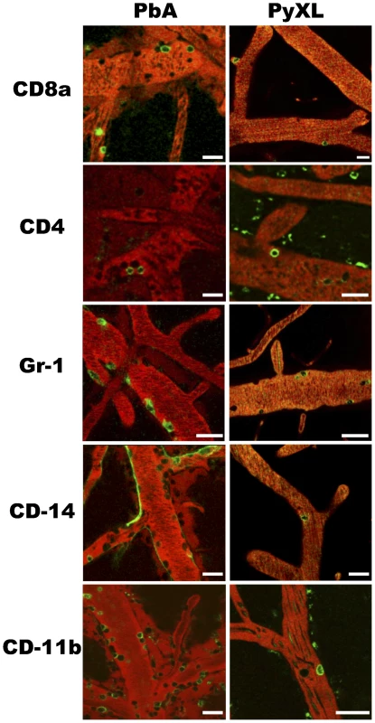 Leukocytes are recruited to cortical postcapillary venules during both ECM and hyperparasitemia.