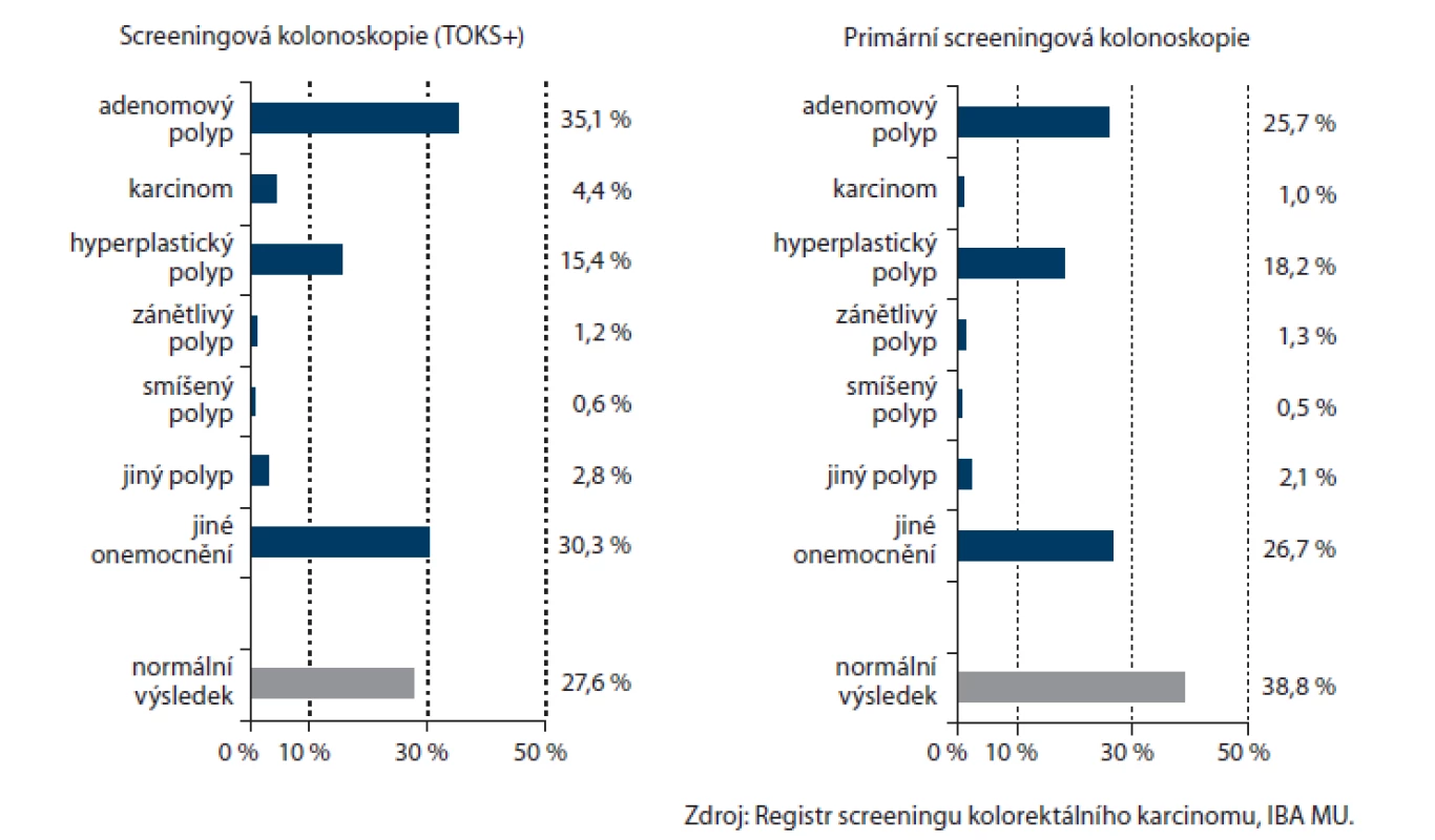 Podíly různých nálezů při screeningové a primární screeningové kolonoskopii (2006–2013).