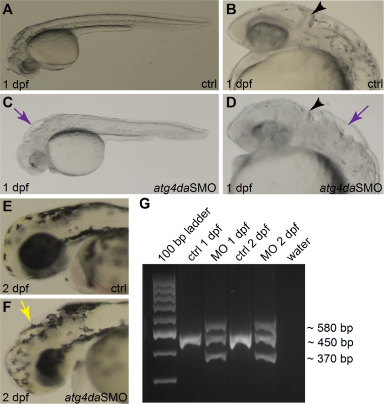Phenotype of <i>atg4da</i> morphant zebrafish embryos.